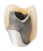 Dental LaserAbutment section view